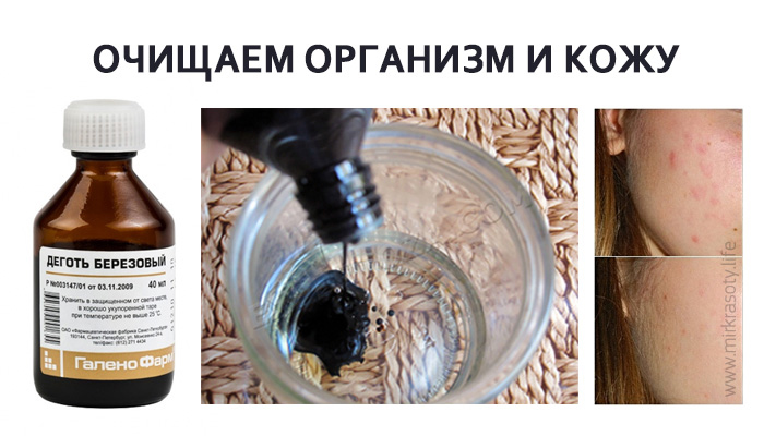 Зубные пломбы в стоматологии - плюсы и минусы, какую пломбу выбрать? Зуб на штифте альтернатива протезу. Противопоказания к установке