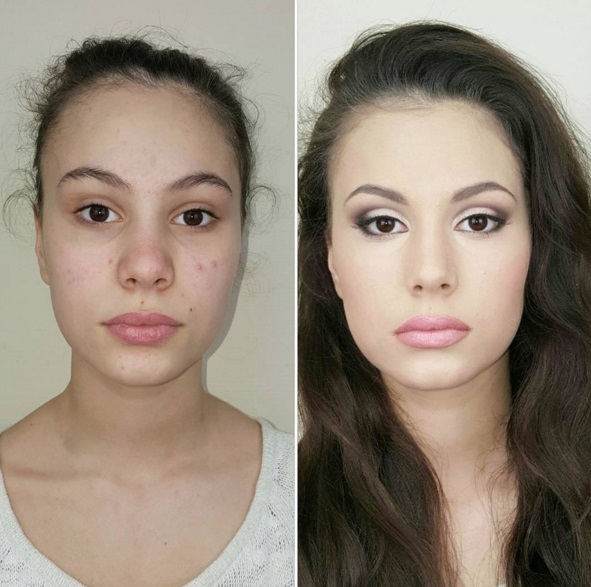 До и после: как макияж может преобразить проблемную кожу