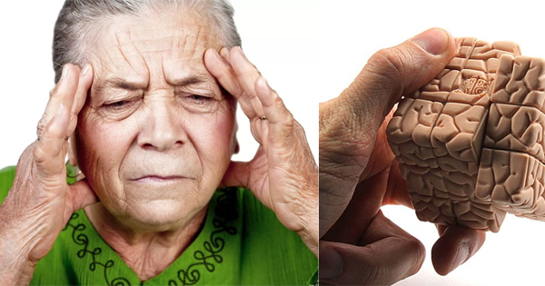Слабоумие ответы. Старческое слабоумие. Слабоумие у пожилых. Старческие болезни головного мозга. Старческое слабоумие картинки.
