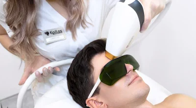 Мужская лазерная эпиляция головы в EPILAS