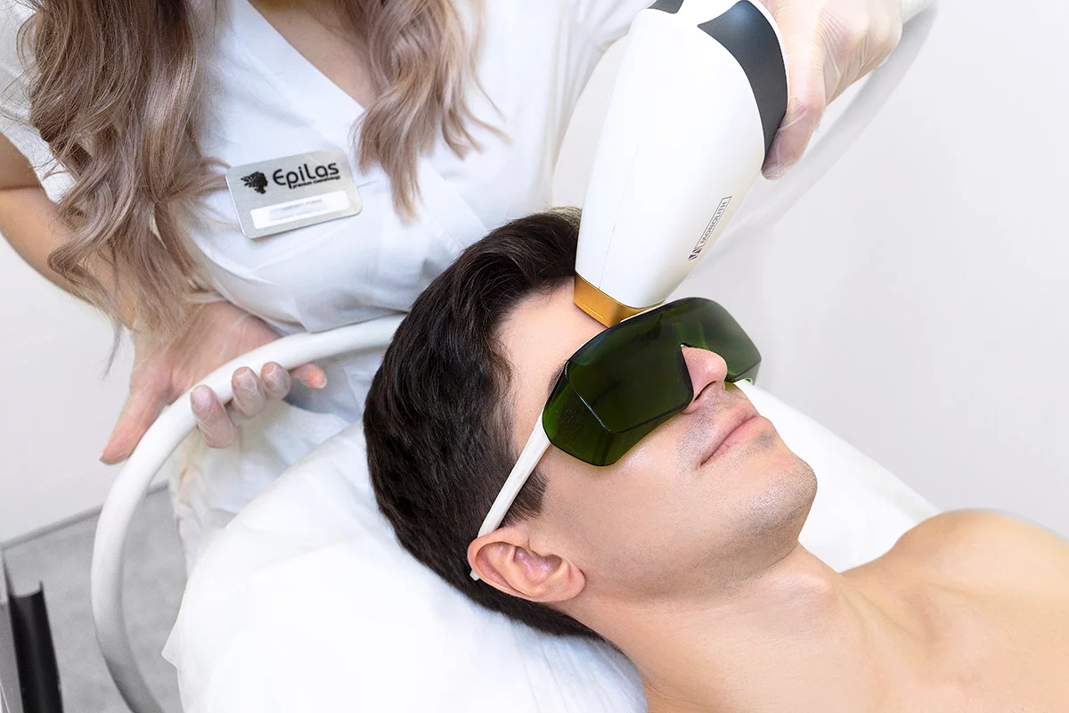 Мужская лазерная эпиляция головы в EPILAS